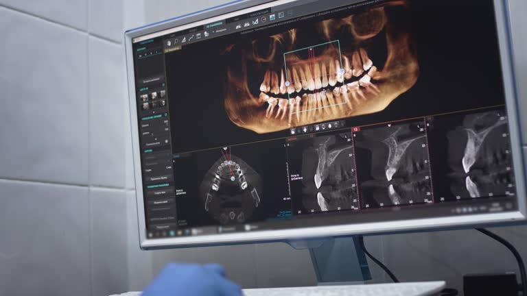 Full Mouth Reconstruction in Stirling, NJ